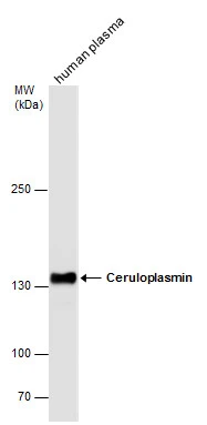 Ceruloplasmin antibody detects Ceruloplasmin protein by western blot analysis. Human tissue extracts (30 μg) was separated by 5% SDS-PAGE, and the membrane was blotted with Ceruloplasmin antibody (GTX113168) diluted at 1:1000. Ceruloplasmin antibody detects Ceruloplasmin protein by western blot analysis. Human tissue extracts (30 μg) was separated by 5% SDS-PAGE, and the membrane was blotted with Ceruloplasmin antibody (GTX113168) diluted at 1:1000.