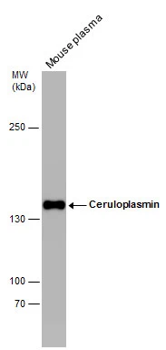 Mouse tissue extract (50 μg) was separated by 5% SDS-PAGE, and the membrane was blotted with Ceruloplasmin antibody [N1N2], N-term (GTX113168) diluted at 1:1000.