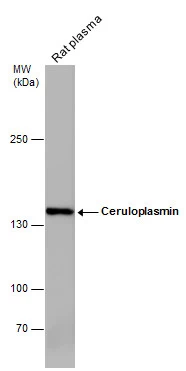 Rat tissue extract (50 μg) was separated by 5% SDS-PAGE, and the membrane was blotted with Ceruloplasmin antibody [N1N2], N-term (GTX113168) diluted at 1:1000.