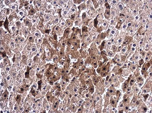Ceruloplasmin antibody [N1N2], N-term detects Ceruloplasmin protein at cytoplasm in mouse liver by immunohistochemical analysis. Sample: Paraffin-embedded mouse liver. Ceruloplasmin antibody [N1N2], N-term (GTX113168) diluted at 1:400. 
 Antigen Retrieval: Citrate buffer, pH 6.0, 15 min