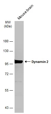 Mouse tissue extract (50 μg) was separated by 7.5% SDS-PAGE, and the membrane was blotted with Dynamin 2 antibody (GTX113171) diluted at 1:5000. The HRP-conjugated anti-rabbit IgG antibody (GTX213110-01) was used to detect the primary antibody.