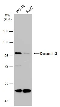 Various whole cell extracts (30 μg) were separated by 7.5% SDS-PAGE, and the membrane was blotted with Dynamin 2 antibody [N1N3] (GTX113171) diluted at 1:1000. The HRP-conjugated anti-rabbit IgG antibody (GTX213110-01) was used to detect the primary antibody.