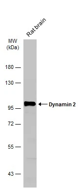 Rat tissue extract (50 μg) was separated by 7.5% SDS-PAGE, and the membrane was blotted with Dynamin 2 antibody [N1N3] (GTX113171) diluted at 1:5000. The HRP-conjugated anti-rabbit IgG antibody (GTX213110-01) was used to detect the primary antibody.