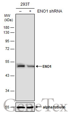 Non-transfected (–) and transfected (+) 293T whole cell extracts (30 μg) were separated by 10% SDS-PAGE, and the membrane was blotted with ENO1 antibody (GTX113179) diluted at 1:20000.