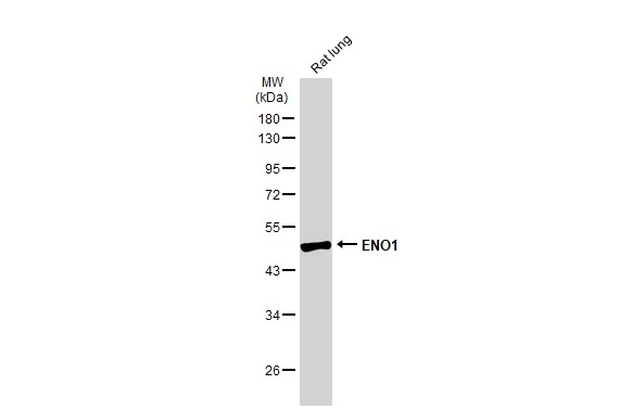 Rat tissue extract (50 μg) was separated by 10% SDS-PAGE, and the membrane was blotted with ENO1 antibody (GTX113179) diluted at 1:1000. The HRP-conjugated anti-rabbit IgG antibody (GTX213110-01) was used to detect the primary antibody.