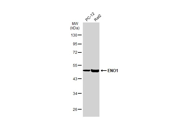 Various whole cell extracts (30 μg) were separated by 10% SDS-PAGE, and the membrane was blotted with ENO1 antibody (GTX113179) diluted at 1:1000. The HRP-conjugated anti-rabbit IgG antibody (GTX213110-01) was used to detect the primary antibody.