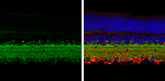 GAD67 antibody detects GAD67 protein expression by immunohistochemical analysis. Sample: Paraffin-Embedded adult mouse retina. Green: GAD67 protein stained by GAD67 antibody (GTX113190) diluted at 1:250. Red: beta Tubulin 3/ TUJ1, stained by beta Tubulin 3/ TUJ1 antibody [GT11710] (GTX631836) diluted at 1:250. Blue: Fluoroshield with DAPI (GTX30920). 
 Antigen Retrieval: Citrate buffer, pH 6.0, 15 min