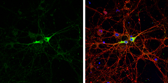 GAD67 antibody detects GAD67 protein by immunofluorescent analysis. Sample: DIV9 rat E18 primary cortical neurons were fixed in 4% paraformaldehyde at RT for 15 min. Green: GAD67 protein stained by GAD67 antibody (GTX113190) diluted at 1:500. Red: beta Tubulin 3/ Tuj1, stained by beta Tubulin 3/ Tuj1 antibody [GT886] (GTX631830) diluted at 1:500. Blue: Fluoroshield with DAPI (GTX30920).