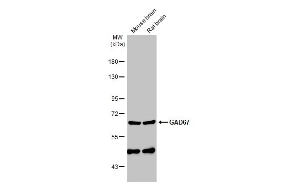 Various tissue extracts (50 μg) were separated by 7.5% SDS-PAGE, and the membrane was blotted with GAD67 antibody (GTX113190) diluted at 1:2000. The HRP-conjugated anti-rabbit IgG antibody (GTX213110-01) was used to detect the primary antibody.