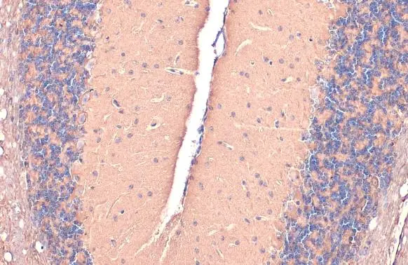 GAD67 antibody detects GAD67 protein at cell membrane and cytoplasm by immunohistochemical analysis. Sample: Paraffin-embedded mouse brain. GAD67 stained by GAD67 antibody (GTX113190) diluted at 1:50. Antigen Retrieval: Citrate buffer, pH 6.0, 15 min