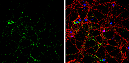 GAD65 antibody