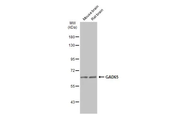 GAD65 antibody