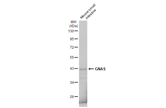 Mouse tissue extract (50 μg) was separated by 10% SDS-PAGE, and the membrane was blotted with GNAS antibody [C2C3-2], C-term (GTX113200) diluted at 1:5000. The HRP-conjugated anti-rabbit IgG antibody (GTX213110-01) was used to detect the primary antibody.