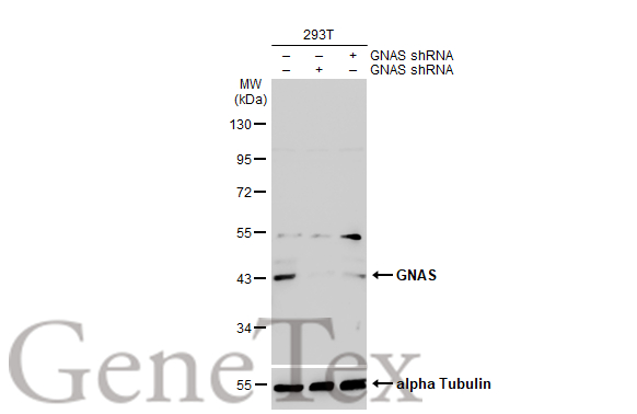 Non-transfected (–) and transfected (+) 293T whole cell extracts (30 μg) were separated by 10% SDS-PAGE, and the membrane was blotted with GNAS antibody [C2C3-2], C-term (GTX113200) diluted at 1:5000. The HRP-conjugated anti-rabbit IgG antibody (GTX213110-01) was used to detect the primary antibody.
