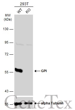 Wild-type (WT) and GPI knockout (KO) 293T cell extracts (30 μg) were separated by 7.5% SDS-PAGE, and the membrane was blotted with GPI antibody (GTX113203) diluted at 1:2000. The HRP-conjugated anti-rabbit IgG antibody (GTX213110-01) was used to detect the primary antibody, and the signal was developed with Trident ECL plus-Enhanced. Wild-type (WT) and GPI knockout (KO) 293T cell extracts (30 μg) were separated by 7.5% SDS-PAGE, and the membrane was blotted with GPI antibody (GTX113203) diluted at 1:2000. The HRP-conjugated anti-rabbit IgG antibody (GTX213110-01) was used to detect the primary antibody, and the signal was developed with Trident ECL plus-Enhanced.