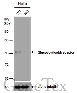 Glucocorticoid Receptor antibody