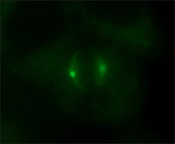 ICC/IF analysis of HeLa cells using GTX11321 gamma Tubulin antibody at 1:1,000. Cells were fixed and permeabilized with methanol followed by acetone. ICC/IF analysis of HeLa cells using GTX11321 gamma Tubulin antibody at 1:1,000. Cells were fixed and permeabilized with methanol followed by acetone.
