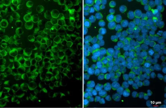 ITK antibody [N2C1], Internal detects ITK protein at cytoplasm by immunofluorescent analysis. Sample: Jurkat cells were fixed in 4% paraformaldehyde at RT for 15 min. Green: ITK stained by ITK antibody [N2C1], Internal (GTX113217) diluted at 1:500. Blue: Fluoroshield with DAPI (GTX30920).