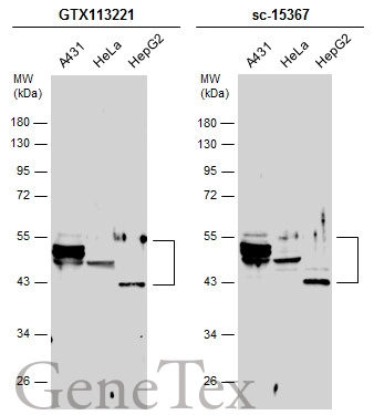 Various whole cell extracts (30 μg) were separated by 10% SDS-PAGE, and the membranes were blotted with Cytokeratin 10 antibody (GTX113221) diluted at 1:10000 and competitor's antibody (sc-15367) diluted at 1:500. The HRP-conjugated anti-rabbit IgG antibody (GTX213110-01) was used to detect the primary antibody.