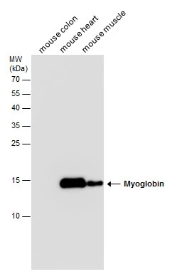 Myoglobin antibody detects Myoglobin protein by Western blot analysis. Mouse tissue extracts (50 μg) was separated by 15 % SDS-PAGE, and the membrane was blotted with Myoglobin antibody (GTX113225) at a dilution of 1:10000.