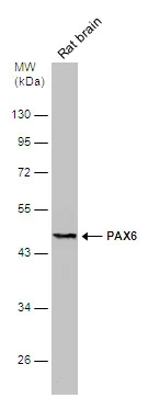 Rat tissue extract (50 μg) was separated by 10% SDS-PAGE, and the membrane was blotted with PAX6 antibody (GTX113241) diluted at 1:500. The HRP-conjugated anti-rabbit IgG antibody (GTX213110-01) was used to detect the primary antibody.