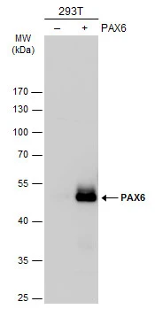 Non-transfected (–) and transfected (+) 293T whole cell extracts (30 μg) were separated by 10% SDS-PAGE, and the membrane was blotted with PAX6 antibody (GTX113241) diluted at 1:1000. The HRP-conjugated anti-rabbit IgG antibody (GTX213110-01) was used to detect the primary antibody.