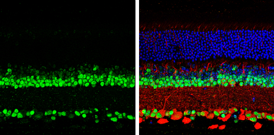 PAX6 antibody detects PAX6 protein by immunohistochemical analysis. Samples: Paraffin-Embedded mouse retina. Green: PAX6 protein stained by PAX6 antibody (GTX113241) diluted at 1:250. Red: beta Tubulin 3/ Tuj1, stained by beta Tubulin 3/ Tuj1 antibody [GT1338] (GTX631831) diluted at 1:500. Blue: Fluoroshield with DAPI (GTX30920). 
 Antigen Retrieval: Citrate buffer, pH 6.0, 15 min
