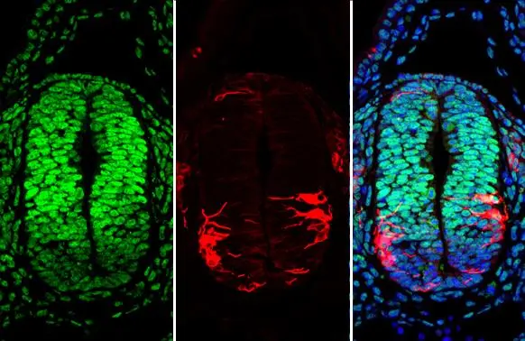 PAX6 antibody detects PAX6 protein at nucleus by immunohistochemical analysis. Sample: Paraffin-embedded mouse E10.5 embryo. Green: PAX6 stained by PAX6 antibody (GTX113241) diluted at 1:250. Red: beta Tubulin 3/ Tuj1, a cytoskeleton marker, stained by beta Tubulin 3/ Tuj1 antibody [GT11710] (GTX631836) diluted at 1:500. Blue: Fluoroshield with DAPI (GTX30920). Antigen Retrieval: Citrate buffer, pH 6.0, 15 min