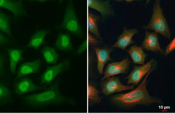 PAX6 antibody detects PAX6 protein at cytoplasm and nucleus by immunofluorescent analysis. Sample: HeLa cells were fixed in 4% paraformaldehyde at RT for 15 min. Green: PAX6 stained by PAX6 antibody (GTX113241) diluted at 1:500. Red: alpha Tubulin, a cytoskeleton marker, stained by alpha Tubulin antibody [GT114] (GTX628802) diluted at 1:1000. Blue: Fluoroshield with DAPI (GTX30920).