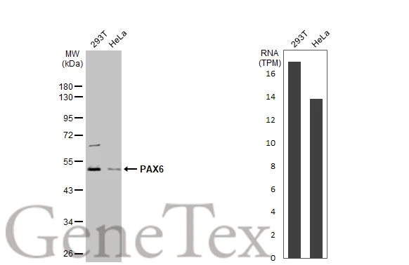 Anti-PAX6 antibody (GTX113241) | GeneTex