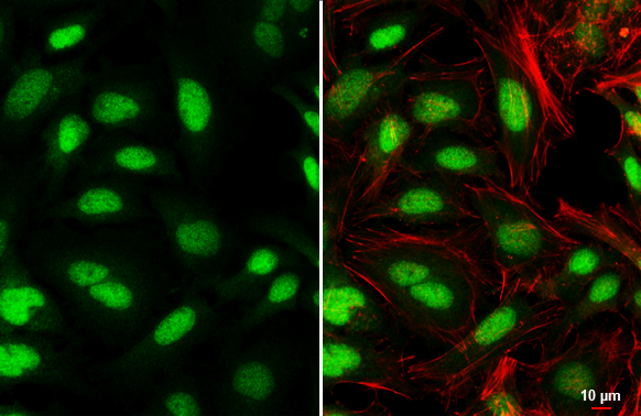 PBX1 antibody detects PBX1 protein at nucleus by immunofluorescent analysis. Sample: HeLa cells were fixed in 4% paraformaldehyde at RT for 15 min. Green: PBX1 stained by PBX1 antibody (GTX113242) diluted at 1:500. Red: phalloidin, a cytoskeleton marker, diluted at 1:100. Scale bar= 10 μm.