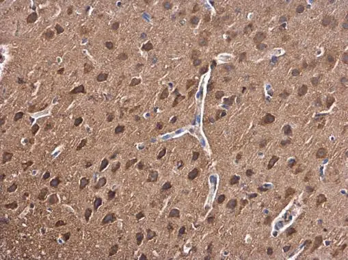 PKC beta antibody detects PKC beta protein at cytoplasm in rat brain by immunohistochemical analysis. Sample: Paraffin-embedded rat brain. PKC beta antibody (GTX113252) diluted at 1:500. 
 Antigen Retrieval: Citrate buffer, pH 6.0, 15 min