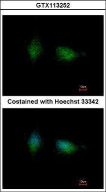 Immunofluorescence analysis of methanol-fixed HeLa,using PKC beta(GTX113252) antibody at 1:500 dilution.