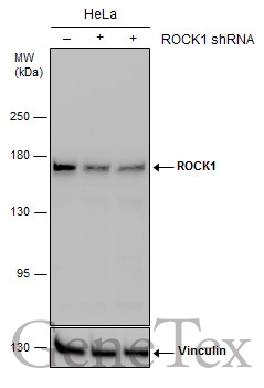 Non-transfected (–) and transfected (+) HeLa whole cell extracts (30 μg) were separated by 5% SDS-PAGE, and the membrane was blotted with ROCK1 antibody [N1N2], N-term (GTX113266) diluted at 1:1000. The HRP-conjugated anti-rabbit IgG antibody (GTX213110-01) was used to detect the primary antibody.