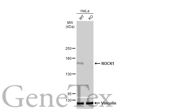 Wild-type (WT) and ROCK1 knockout (KO) HeLa cell extracts (30 μg) were separated by 5% SDS-PAGE, and the membrane was blotted with ROCK1 antibody [N1N2], N-term (GTX113266) diluted at 1:1000. The HRP-conjugated anti-rabbit IgG antibody (GTX213110-01) was used to detect the primary antibody.