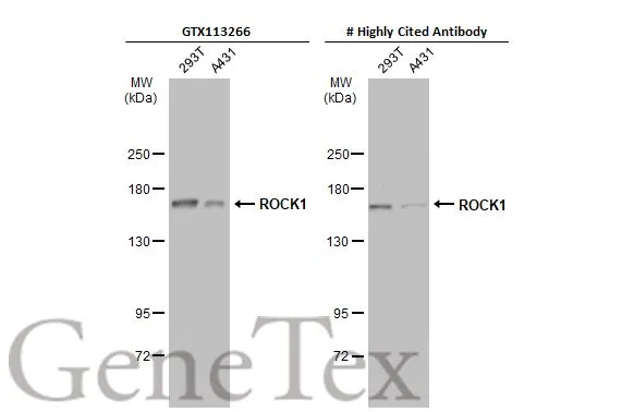 Various whole cell extracts (30 μg) were separated by 5% SDS-PAGE, and the membranes were blotted with ROCK1 antibody [N1N2], N-term (GTX113266) diluted at 1:1000 and competitor's antibody diluted at 1:1000. The HRP-conjugated anti-rabbit IgG antibody (GTX213110-01) was used to detect the primary antibody, and the signal was developed with Trident ECL plus-Enhanced. *The competitor is not affiliated with GeneTex and does not endorse this product.