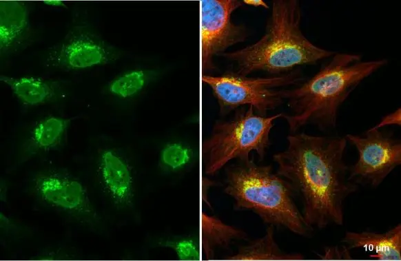 ROCK1 antibody [N1N2], N-term detects ROCK1 protein at nucleus and Golgi apparatus by immunofluorescent analysis. Sample: HeLa cells were fixed in 4% paraformaldehyde at RT for 15 min. Green: ROCK1 stained by ROCK1 antibody [N1N2], N-term (GTX113266) diluted at 1:500. Red: alpha Tubulin, a cytoskeleton marker, stained by alpha Tubulin antibody [GT114] (GTX628802) diluted at 1:1000. Blue: Fluoroshield with DAPI (GTX30920).