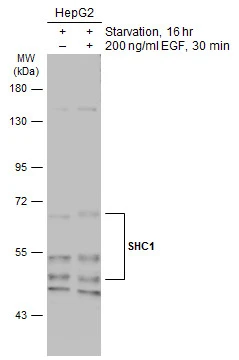 Untreated (–) and treated (+) HepG2 whole cell extracts (30 μg) were separated by 7.5% SDS-PAGE, and the membrane was blotted with SHC1 antibody [N3C2], Internal (GTX113267) diluted at 1:500. The HRP-conjugated anti-rabbit IgG antibody (GTX213110-01) was used to detect the primary antibody.