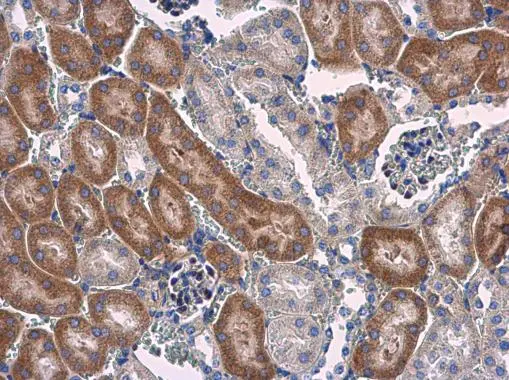 STAT6 antibody