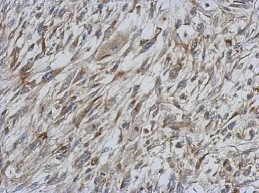 STAT6 antibody