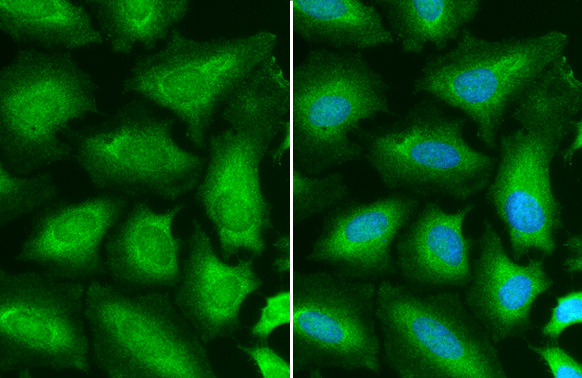 STAT6 antibody detects STAT6 protein at cytoplasm and nucleus by immunofluorescent analysis. Sample: HeLa cells were fixed in 4% paraformaldehyde at RT for 15 min. Green: STAT6 stained by STAT6 antibody (GTX113273) diluted at 1:500. Blue: Hoechst 33342 staining.