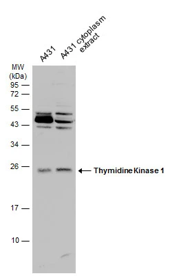 A431 whole cell and cytoplasm extracts (30 μg) were separated by 12% SDS-PAGE, and the membrane was blotted with Thymidine Kinase 1 antibody (GTX113281) diluted at 1:1000.