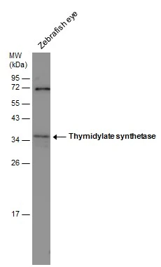 Zebrafish tissue extract (30 μg) was separated by 12% SDS-PAGE, and the membrane was blotted with Thymidylate synthetase antibody [N3C3] (GTX113289) diluted at 1:500.