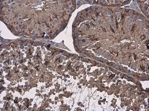 Vinculin antibody [N1N3] detects Vinculin protein at cytoplasm in mouse testis by immunohistochemical analysis. Sample: Paraffin-embedded mouse testis. Vinculin antibody [N1N3] (GTX113294) diluted at 1:500. 
 Antigen Retrieval: Citrate buffer, pH 6.0, 15 min