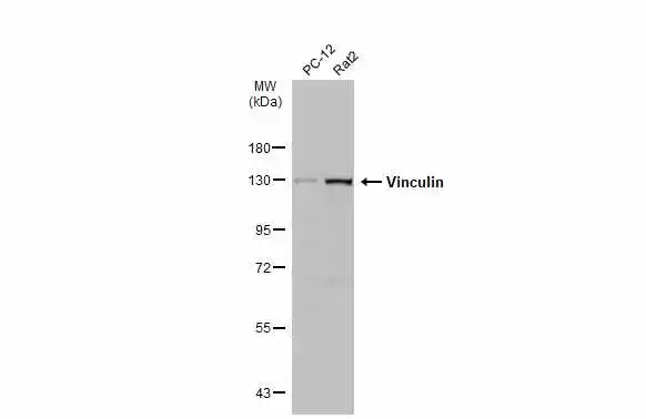 Various whole cell extracts (30 μg) were separated by 7.5% SDS-PAGE, and the membrane was blotted with Vinculin antibody [N1N3] (GTX113294) diluted at 1:1000. The HRP-conjugated anti-rabbit IgG antibody (GTX213110-01) was used to detect the primary antibody.