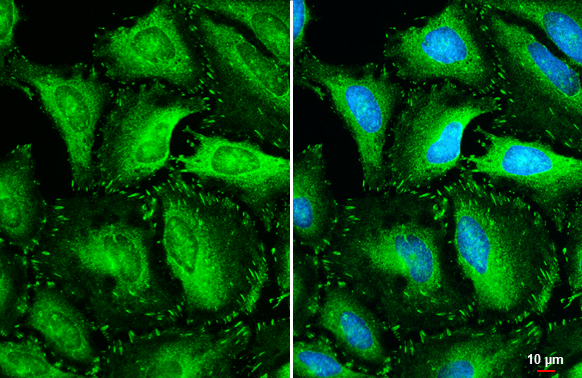 Anti-Vinculin antibody [N1N3] (GTX113294) | GeneTex