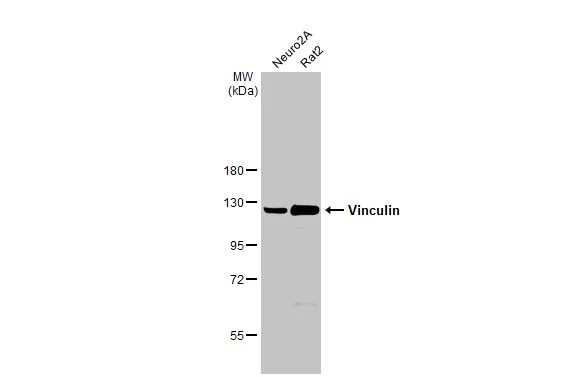 Various whole cell extracts (50 μg) were separated by 7.5% SDS-PAGE, and the membrane was blotted with Vinculin antibody [N1N3] (GTX113294) diluted at 1:1000. The HRP-conjugated anti-rabbit IgG antibody (GTX213110-01) was used to detect the primary antibody.