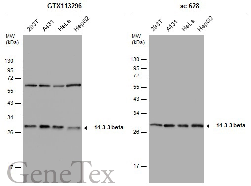 Various whole cell extracts (30 μg) were separated by 12% SDS-PAGE, and the membranes were blotted with 14-3-3 beta antibody [N1C2] (GTX113296) diluted at 1:10000 and competitor's antibody (sc-628) diluted at 1:200. The HRP-conjugated anti-rabbit IgG antibody (GTX213110-01) was used to detect the primary antibody.