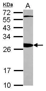 Sample (20 ug of whole cell lysate) A: mouse brain 12% SDS PAGE GTX113296 diluted at 1:10000 Sample (20 ug of whole cell lysate) A: mouse brain 12% SDS PAGE GTX113296 diluted at 1:10000