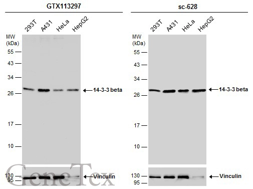 Various whole cell extracts (30 μg) were separated by 12% SDS-PAGE, and the membranes were blotted with 14-3-3 beta antibody [N1C2] (GTX113297) diluted at 1:5000 and competitor's antibody (sc-628) diluted at 1:1000. The HRP-conjugated anti-rabbit IgG antibody (GTX213110-01) was used to detect the primary antibody.